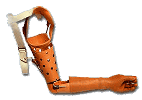 Hybridprotese